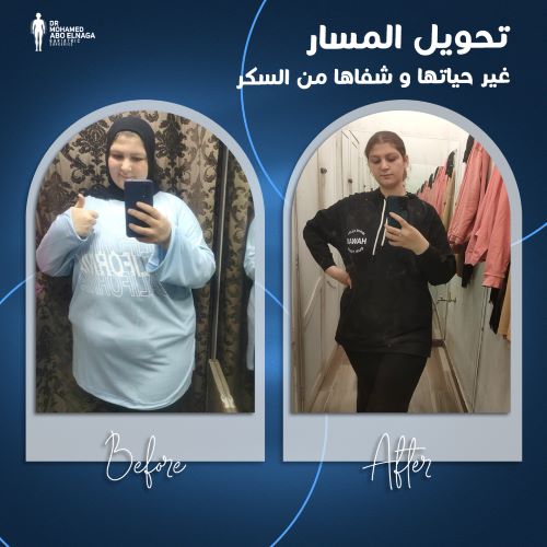 هل يرجع الوزن بعد تحويل المسار